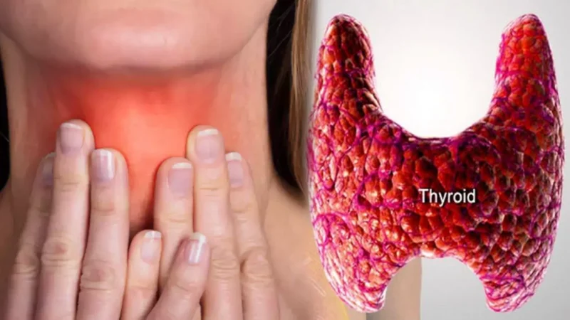 Thyroid कंट्रोल करने के 4 उपाय